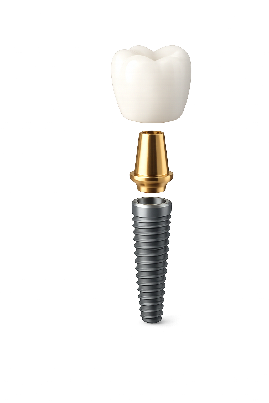 Implante dental de titanio